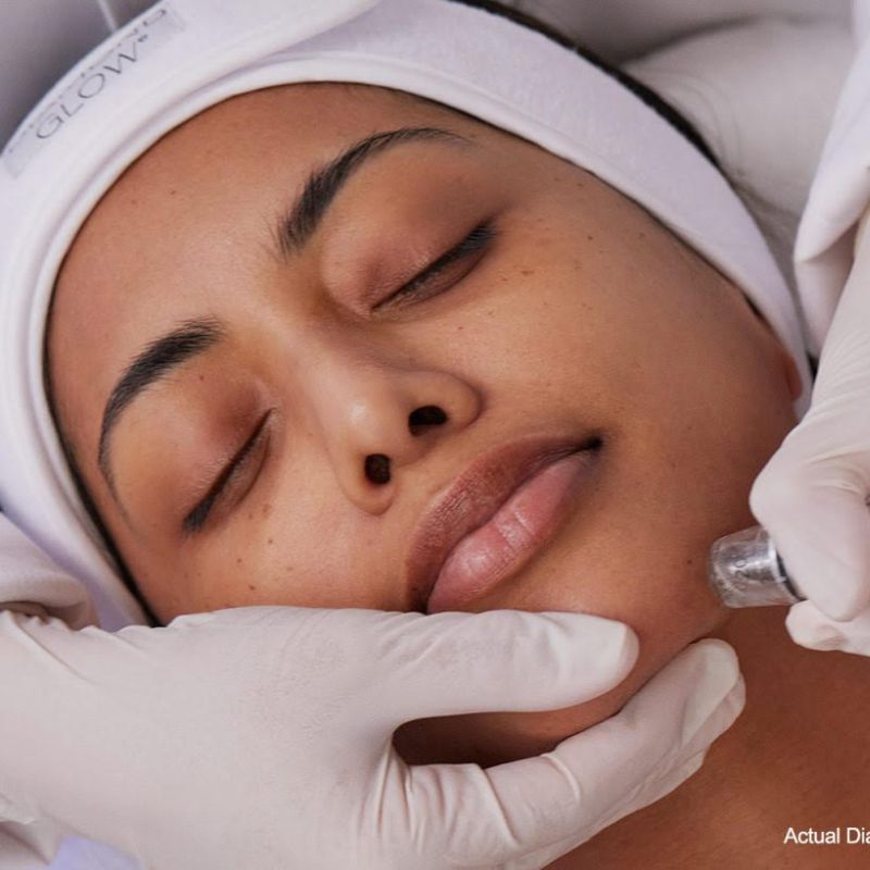 Diamond Glow Facial